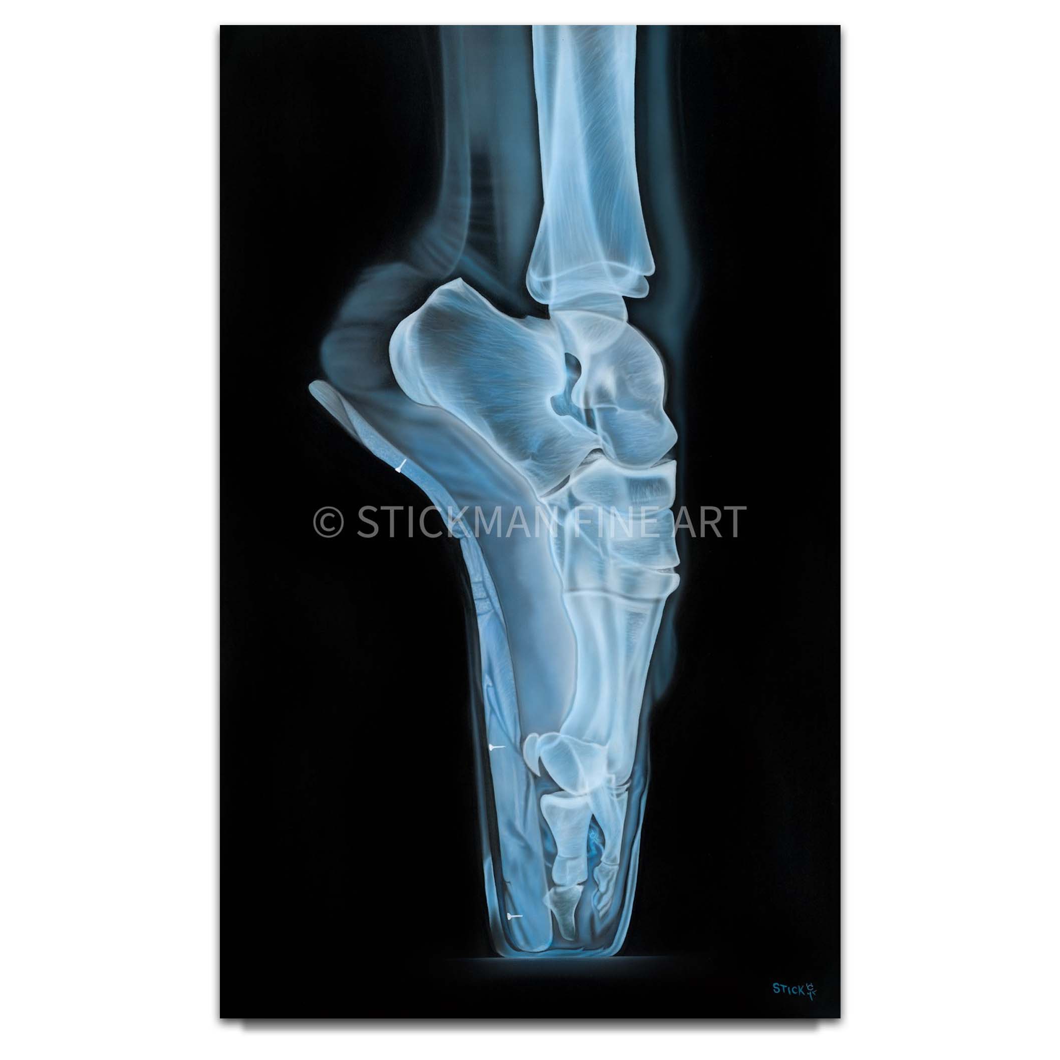 Stickman Ballerina, You Must Have Seen Her (Elton John Tribute Ballet Xray) Limited Edition Giclee