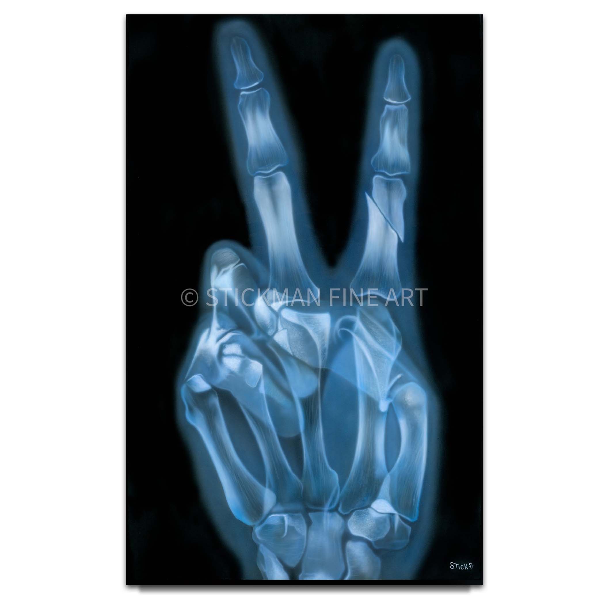 Stickman Love is All You Need (X-Ray / Ringo) Limited Edition Giclee